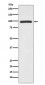 Anti-HMGCR/Hmg Coa Reductase Rabbit Monoclonal Antibody