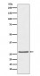 Anti-TIMP1 Rabbit Monoclonal Antibody