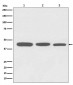 Anti-Actin ACTA1 Rabbit Monoclonal Antibody