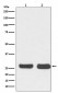 Anti-Bcl-2 Rabbit Monoclonal Antibody