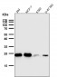 Anti-Bcl-2 Rabbit Monoclonal Antibody