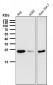 Anti-Bcl-2 Rabbit Monoclonal Antibody