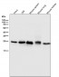 Anti-Bcl-2 Rabbit Monoclonal Antibody