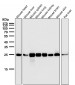 Anti-Bcl-2 Rabbit Monoclonal Antibody