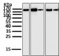Anti-FGFR2 Rabbit Monoclonal Antibody