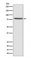 Anti-Ezrin Rabbit Monoclonal Antibody