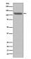 Anti-FGFR3 Rabbit Monoclonal Antibody