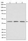 Anti-PRMT1 Rabbit Monoclonal Antibody