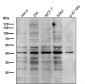 Anti-PRMT1 Rabbit Monoclonal Antibody