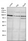 Anti-GRP94 HSP90B1 Rabbit Monoclonal Antibody