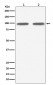 Anti-FGFR3 Rabbit Monoclonal Antibody