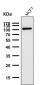 Anti-FGFR3 Rabbit Monoclonal Antibody