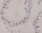 Anti-XRCC1 Rabbit Monoclonal Antibody