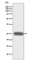 Anti-G-CSF CSF3 Rabbit Monoclonal Antibody