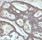 Anti-53BP1 TP53BP1 Rabbit Monoclonal Antibody