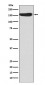 Anti-CD163 Rabbit Monoclonal Antibody