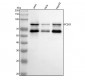 Anti-PCSK9/Proprotein Convertase 9 Rabbit Monoclonal Antibody