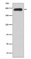 Anti-MYH11 Rabbit Monoclonal Antibody