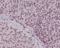 Anti-FoxO3a Rabbit Monoclonal Antibody