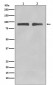 Anti-FoxO3a Rabbit Monoclonal Antibody