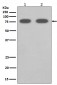 Anti-SCARB1/Sr Bi Rabbit Monoclonal Antibody