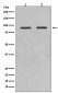 Anti-FoxO1a Rabbit Monoclonal Antibody