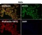 Anti-TOMM20/Tom20 Rabbit Monoclonal Antibody