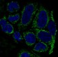 Anti-TOMM20/Tom20 Rabbit Monoclonal Antibody