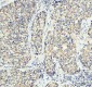 Anti-TOMM20/Tom20 Rabbit Monoclonal Antibody