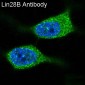 Anti-Lin28B Rabbit Monoclonal Antibody