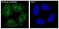 Anti-S100A4 Rabbit Monoclonal Antibody