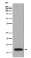 Anti-S100A4 Rabbit Monoclonal Antibody