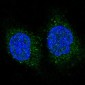 Anti-FoxO3a Rabbit Monoclonal Antibody