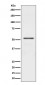 Anti-Parkin PARK2 Rabbit Monoclonal Antibody