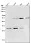 Anti-Parkin PARK2 Rabbit Monoclonal Antibody