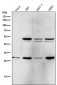 Anti-Parkin PARK2 Rabbit Monoclonal Antibody