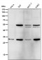 Anti-Parkin PARK2 Rabbit Monoclonal Antibody