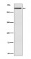 Anti-Cubilin CUBN Rabbit Monoclonal Antibody