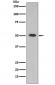 Anti-ALDH1A1 Rabbit Monoclonal Antibody