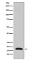 Anti-p16 ARC ARPC5 Rabbit Monoclonal Antibody