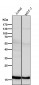 Anti-p16 ARC ARPC5 Rabbit Monoclonal Antibody