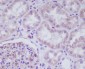 Anti-ADIPOR1 Rabbit Monoclonal Antibody