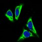 Anti-TNFAIP3/A20 Rabbit Monoclonal Antibody