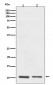 Anti-S100A10 Rabbit Monoclonal Antibody