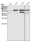 Anti-ER alpha ESR1 Rabbit Monoclonal Antibody