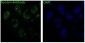 Anti-Survivin BIRC5 Rabbit Monoclonal Antibody