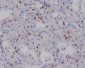 Anti-Survivin BIRC5 Rabbit Monoclonal Antibody