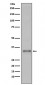 Anti-Torsin A TOR1A Rabbit Monoclonal Antibody