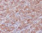 Anti-Paxillin PXN Rabbit Monoclonal Antibody