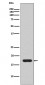 Anti-IL1 beta Rabbit Monoclonal Antibody